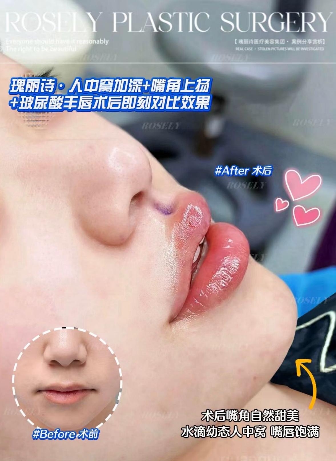 b7ffdc34d169aeaf2de68ca00e218a65.jpg